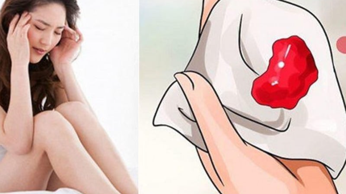 kinh-nguyet-2-17827229445781700825059 Cục máu đông là hiện tượng thường gặp trong kỳ kinh nguyệt.