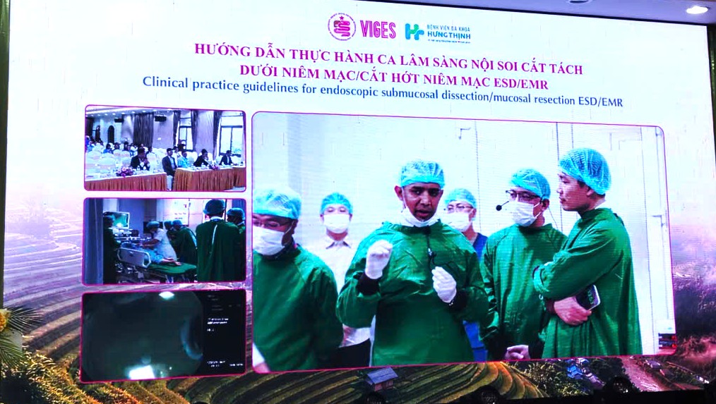 Nâng Cao Chất Lượng Nội Soi Tiêu Hóa- Ảnh 2.