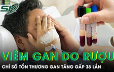 Câu Chuyện Thú Vị Về Một Người Đàn Ông Bị Ấu Trùng Sán Dây Suốt 12 Năm