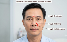 5 Món Canh Bổ Dưỡng Từ Củ Sen Dễ Làm Tại Nhà