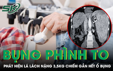 Lý Do Sự Gia Tăng Gan Nhiễm Mỡ Ở Giới Trẻ: Một Tình Trạng Cảnh Báo