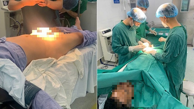 Gãy dương vật sau cú va chạm bất ngờ khi quan hệ, người đàn ông 47 tuổi phải mổ cấp cứu - Ảnh 1. Gãy dương vật sau cú va chạm bất ngờ khi quan hệ, người đàn ông 47 tuổi phải mổ cấp cứu - Ảnh 1.