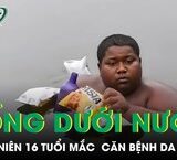Cảnh Báo Về Các Biến Chứng Sức Khỏe Từ Chế Độ Ăn Sai Lầm