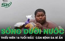 Cảnh Báo Về Các Biến Chứng Sức Khỏe Từ Chế Độ Ăn Sai Lầm
