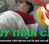 Bi kịch khi người phụ nữ bị ong vò vẽ tấn công dẫn đến tử vong