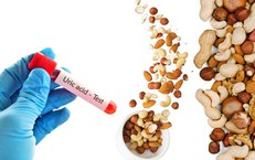 Bệnh viện S.I.S Cần Thơ Đạt Chứng Nhận SILC Về Can Thiệp Đột Quỵ