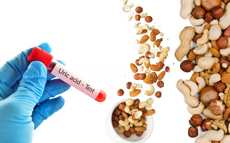 Nâng Cao Hiểu Biết Về Tăng Acid Uric: Nguyên Nhân, Hậu Quả và Giải Pháp Hiệu Quả