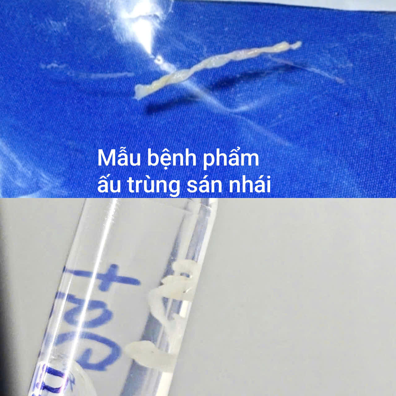 au-trung-san-nhai-17866090457232125237772 Suýt mang họa vì vô tình uống nước suối khi bơi- Ảnh 2.