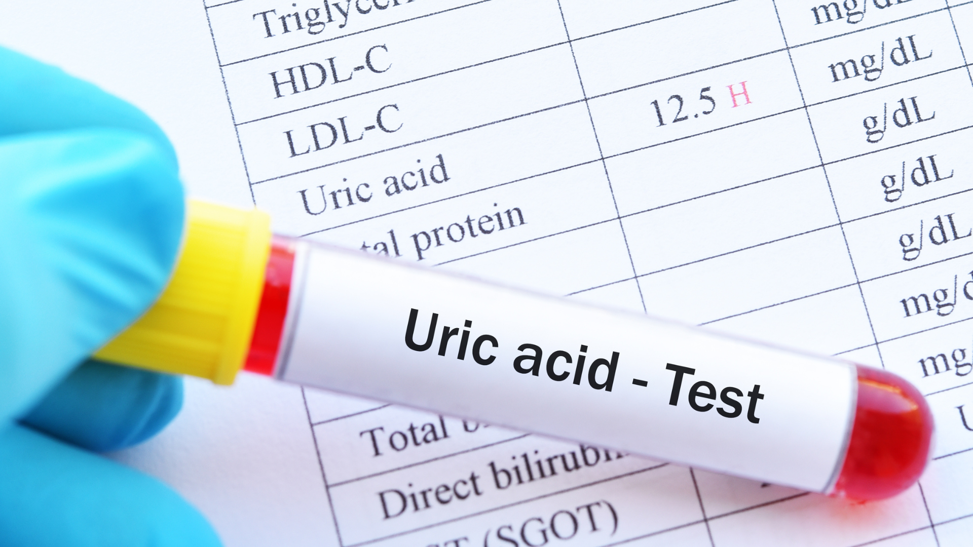 Tăng acid uric có làm suy giảm ‘bản lĩnh’ nam giới? - Ảnh 1.