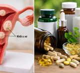 Những Thực Phẩm Bổ Sung Cần Tránh Khi Dùng Canxi