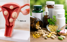 Những Thực Phẩm Bổ Sung Cần Tránh Khi Dùng Canxi