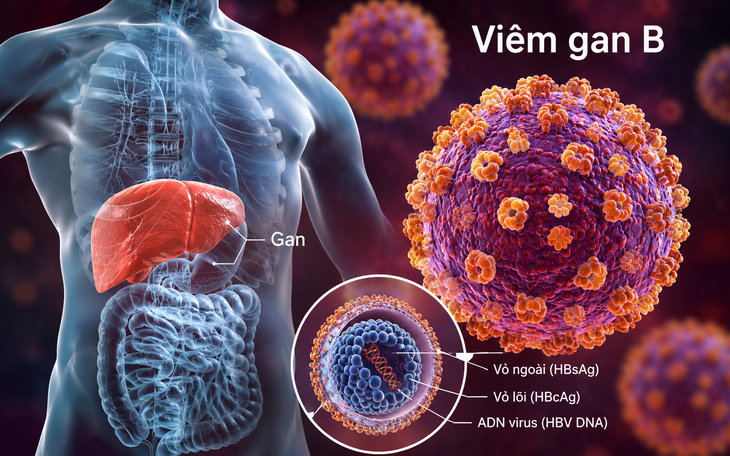 Vì sao viêm gan B và C vẫn gây tử vong dù đã có vắc xin và thuốc điều trị? - Ảnh 2.