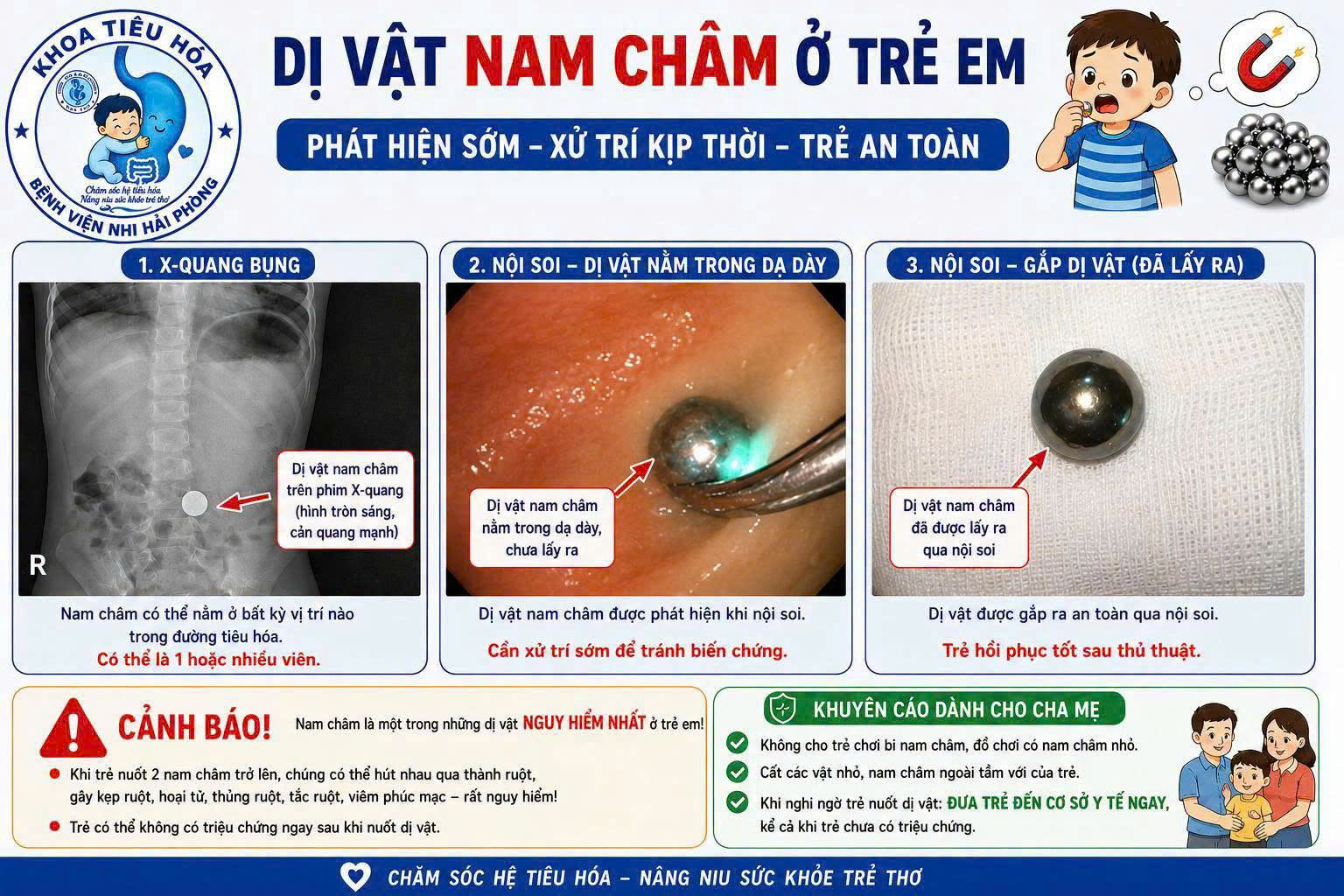 Bác sĩ khuyến cáo không cho trẻ chơi bi nam châm để tránh dị vật nguy hiểm - Ảnh 1.