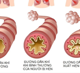 Nguy Cơ Đuối Nước: Nhận Biết Dấu Hiệu Cần Can Thiệp Ngay Đối Với Trẻ Em