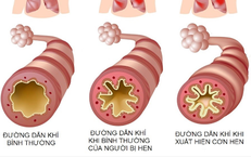 Nguy Cơ Đuối Nước: Nhận Biết Dấu Hiệu Cần Can Thiệp Ngay Đối Với Trẻ Em