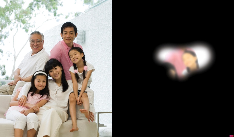 Những Nguy Cơ Của Glaucoma: Dấu Hiệu, Điều Trị và Biện Pháp Phòng Ngừa