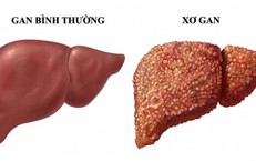Những Tác Động Của Ca Đêm Đến Sức Khỏe và Các Giải Pháp Khắc Phục