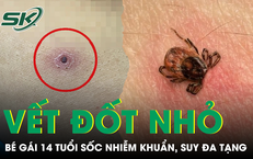 Nguy Cơ Suy Thận Từ Việc Uống Nước Để Dưới Nắng Hè