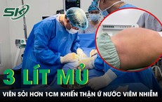 Vắc xin mRNA của Nga: lời tuyên bố về tiêu diệt tế bào ung thư và những câu hỏi bạn nên đặt ra