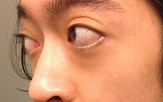 Những Điều Cần Lưu Ý Khi Sử Dụng Thuốc Cường Dương Cho Người Có Bệnh Tim