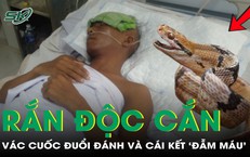 Viên sỏi thận hơn 1cm: Khi một khối nhỏ có thể đe dọa chức năng thận